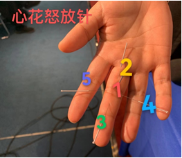 照片5.png